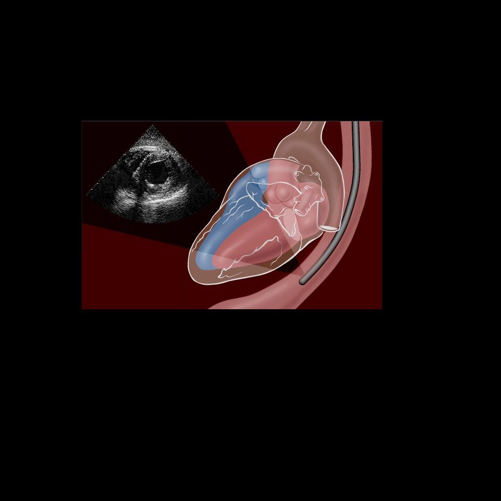 Echocardiography Board Review Questions Simulation icon