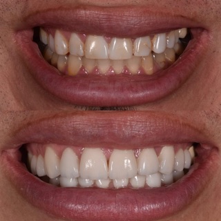 Mirror Cosmetic Dentistry: Homa Shahriari, DDS