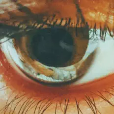 Ascolta Calioppe, guarda video musicali, leggi la biografia, vedi le date del tour & altro!