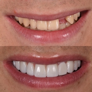 Mirror Cosmetic Dentistry: Homa Shahriari, DDS