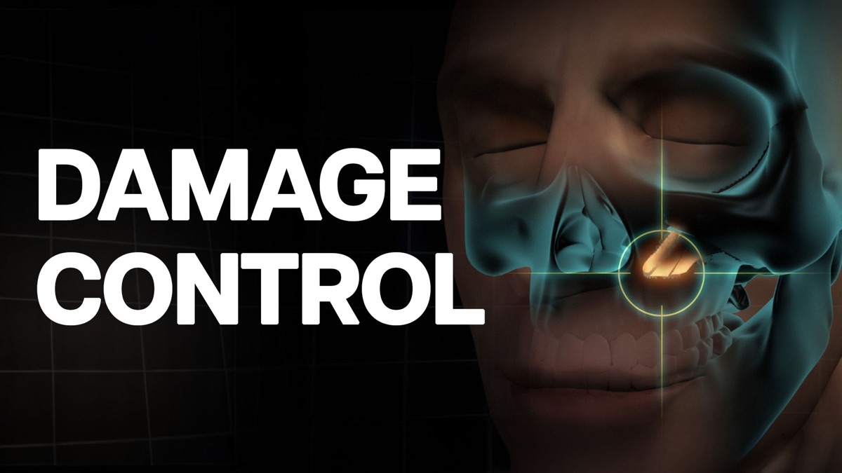 ‎Damage Control - Apple TV