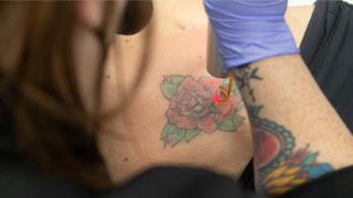 Removery Tattoo Removal & Fading tattoo studio photo