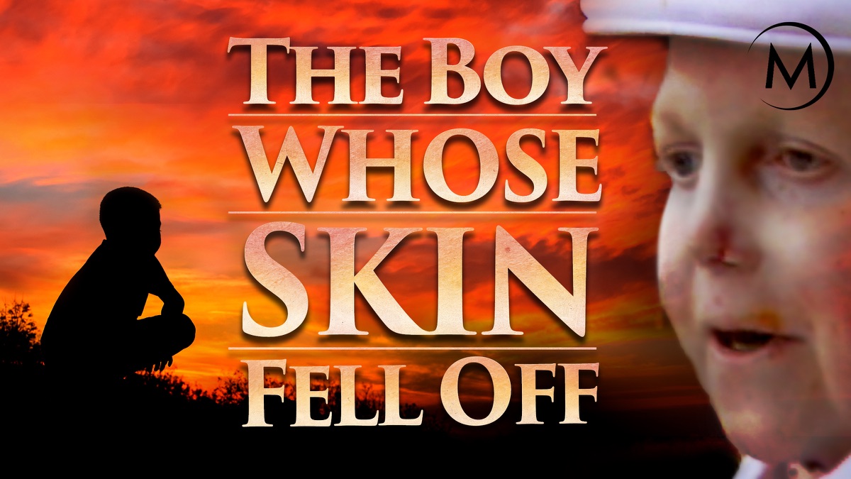 The Boy Whose Skin Fell Off - Apple TV (UK)
