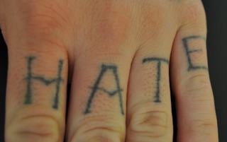 Tattoo Vanish