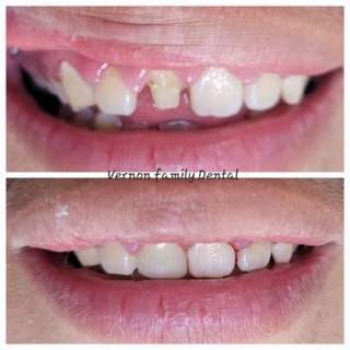 Vernon Family Dental