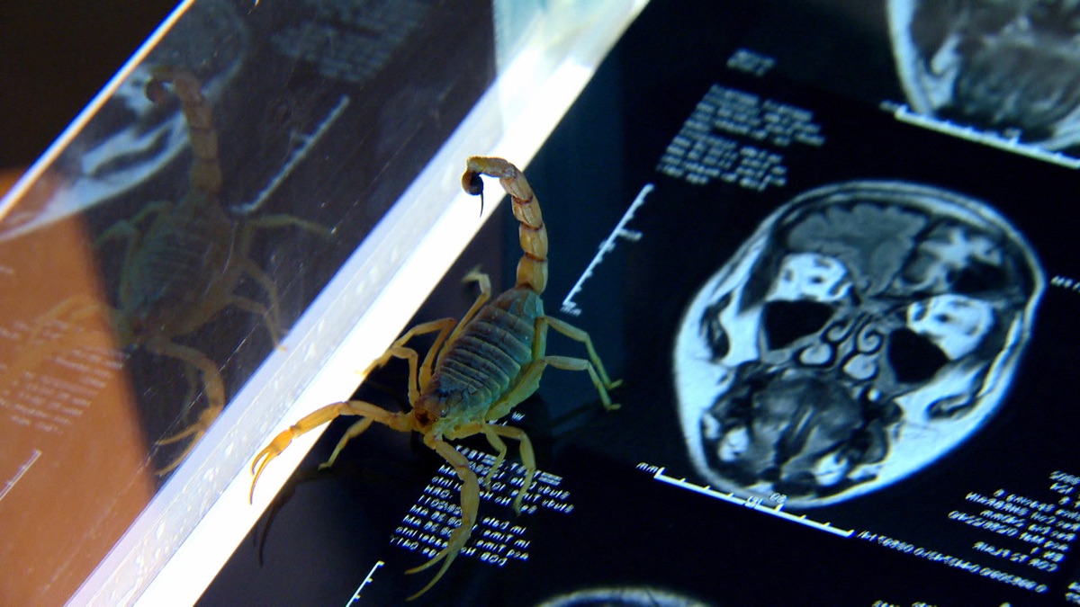 Poison — From Pain to Poison: How Drugs Revolutionized Medicine | Apple TV