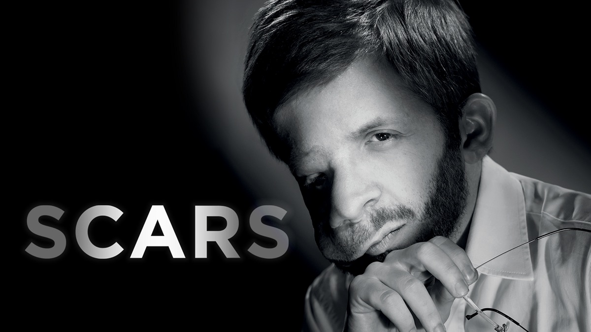 ‎Scars - Apple TV