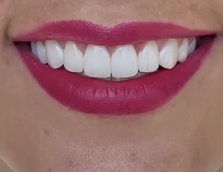 Pasadena Family, Cosmetic & Implant Dentistry