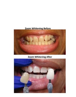 Gardena Family Dental - K Yamazaki DDS