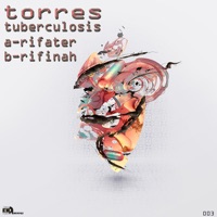 Tuberculosis - Single - Torres