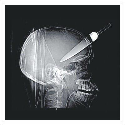 Frankie Teardrop - Single