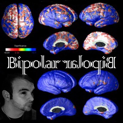 Bipolar