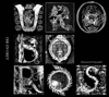 UROBOROS [Remastered & Expanded] - DIR EN GREY new Single