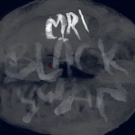 Round&Round MRI