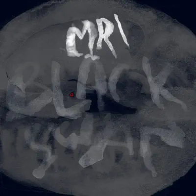 Listen to Black Swan by MRI