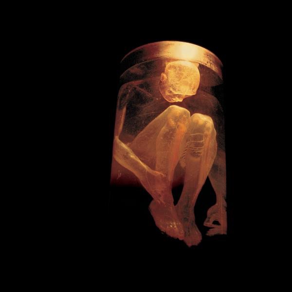 Обложка альбома «Nothing Safe: The Best of the Box» — Alice In Chains