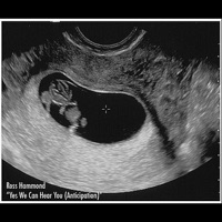 Yes We Can Hear You (Anticipation) - Single - Ross Hammond