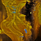 The Surgery of Touch