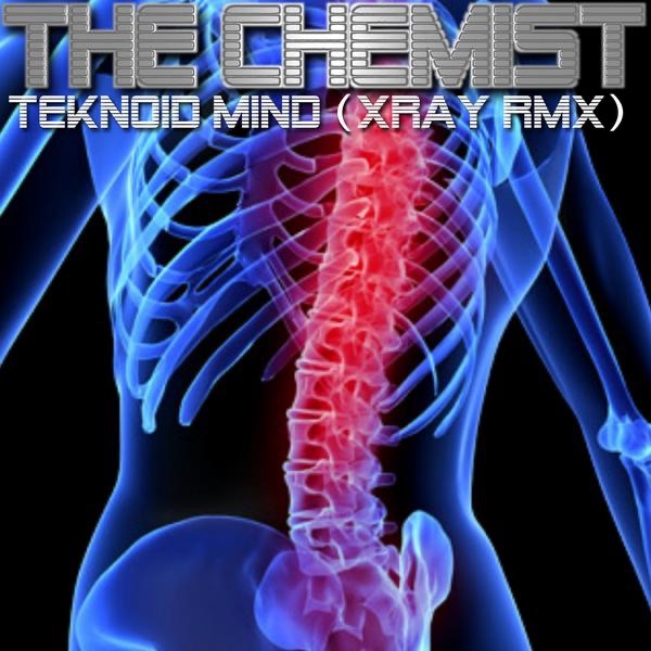 Teknoid Mind (Xray Remix) - Single