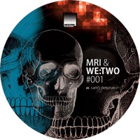 #001 - Single - MRI & WE:TWO