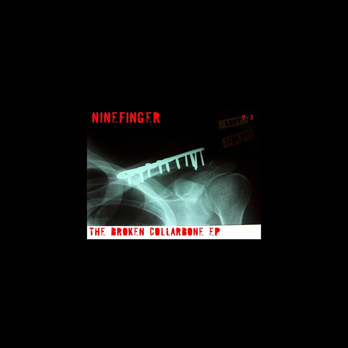 The Broken Collarbone EP - EP by Ninefinger on Apple Music