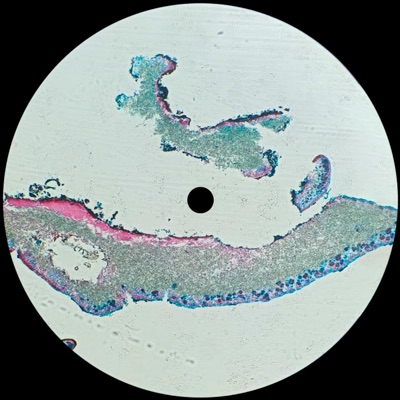 Liquen - Single