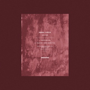 Fracture - Single