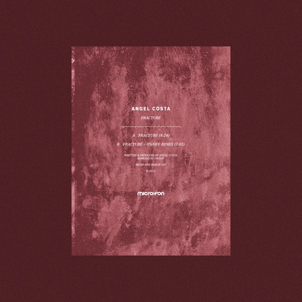 Fracture - Single