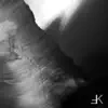 Quasar