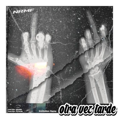 Otra Vez Tarde - Single