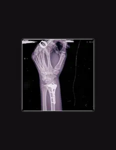 Listen to T. WIK, watch music videos, read bio, see tour dates & more!