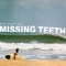 Missing Teeth - Boy Named Sue lyrics