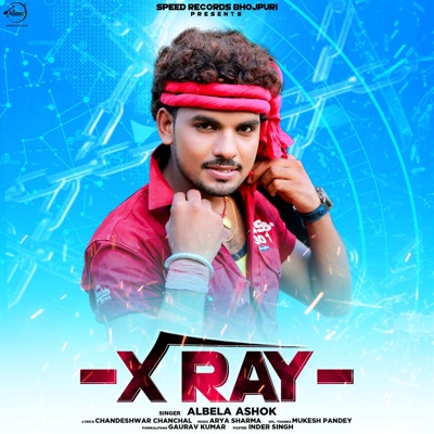 X Ray - Single