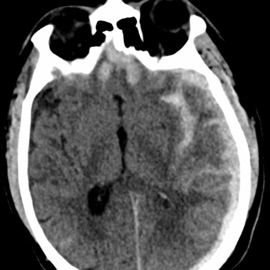 The Interworkings of Love Łucid dreamer