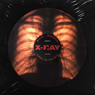 X-Ray - Single