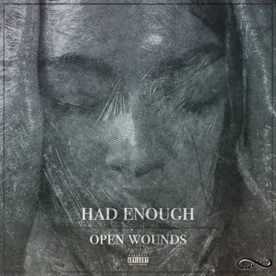 Open Wounds