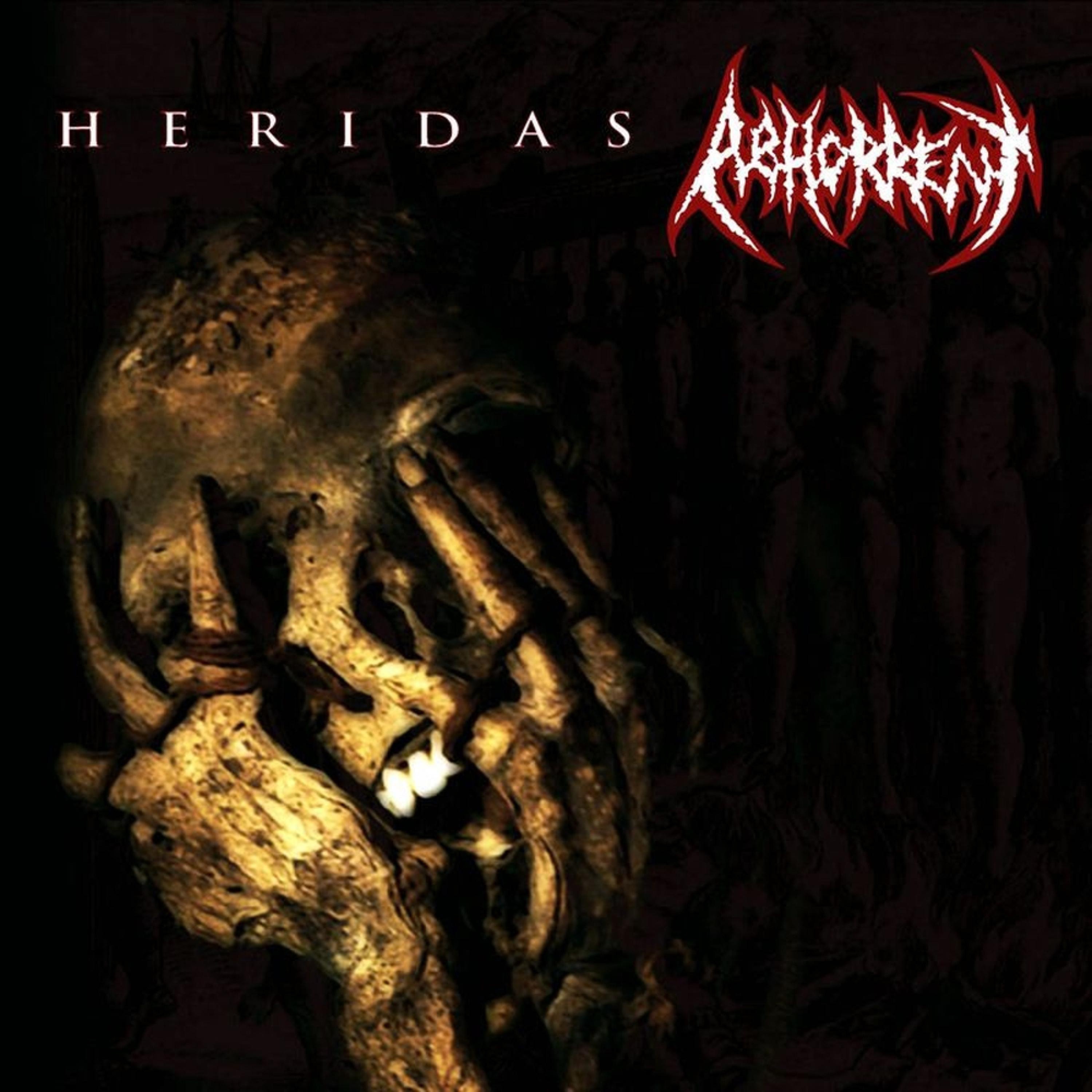 Heridas