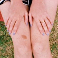 Freckles - Netherfriends