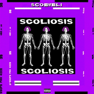 Scoliosis