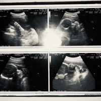 Lost Pictures (feat. Yatchy) - Single - Dreamrepublicanz