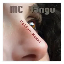 Pólipo Nasal - Single - MC Bangu Pólipo Nasal - Single - MC Bangu