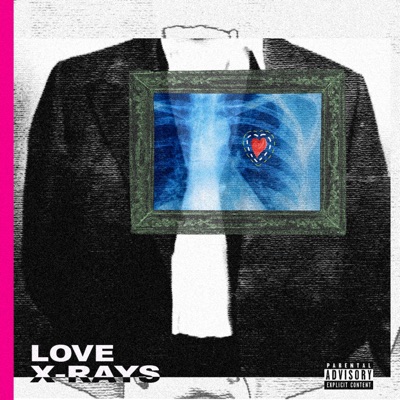 Love X-Rays - EP
