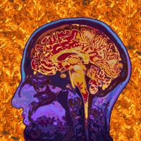 Midas - Single - Sterfry