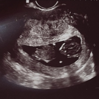 Someday Never Comes - Single