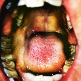 Everybody's Birthday Hana Vu