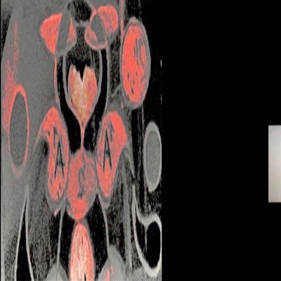 S(e)uche[n] - Single