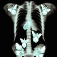 Butterflies - Single - Inthemorning