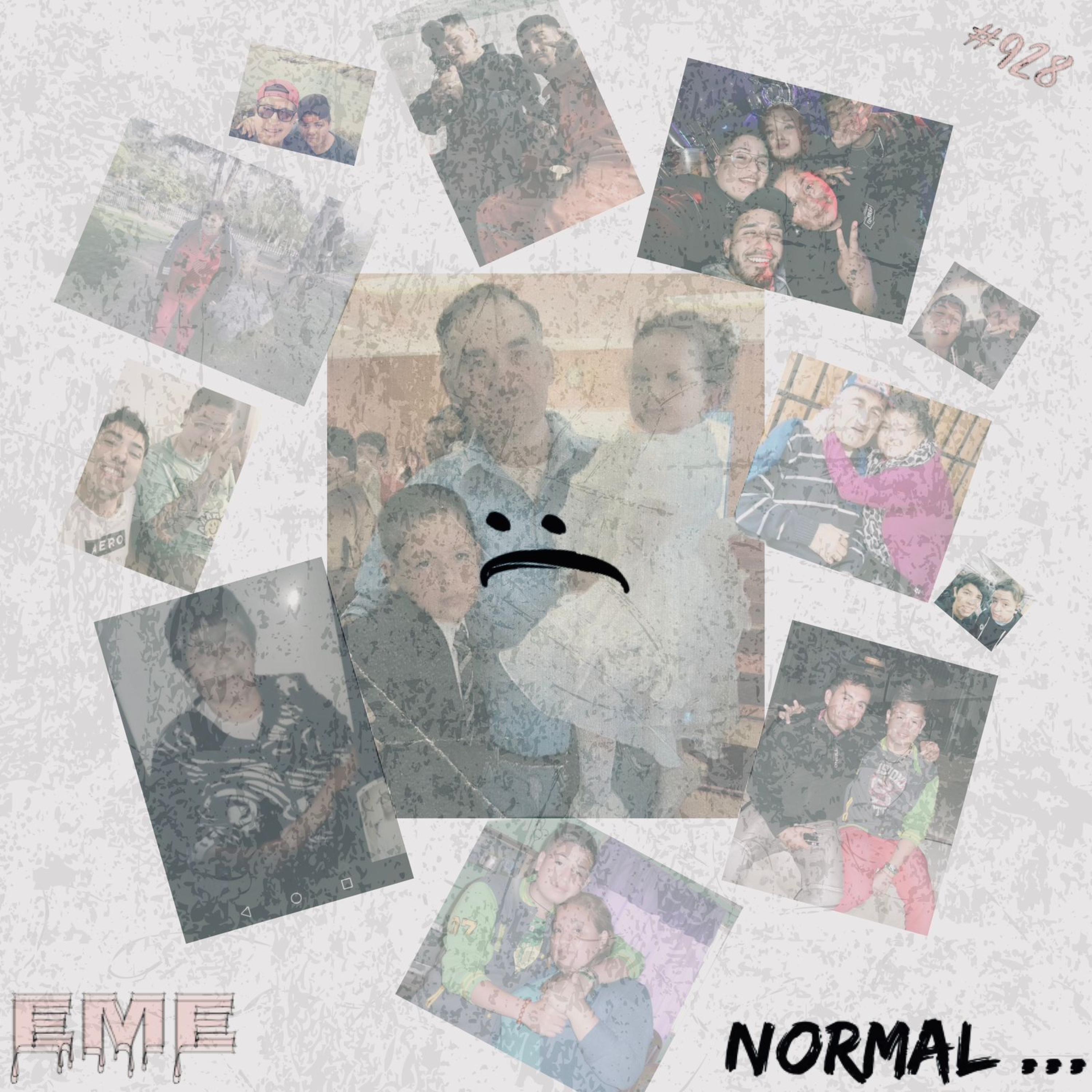 Normal - Single