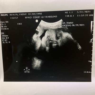 9 Months Pregnant - Single