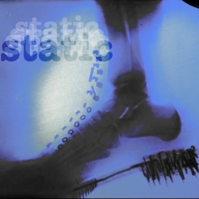 Static - Single